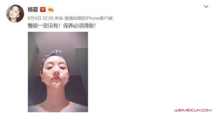杨蓉曾自曝想整容事件始末 武汉整容杨蓉割双眼皮是同名同姓吗？