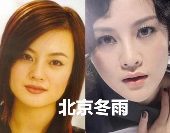 10大漂亮女星打瘦脸针前后容颜拼