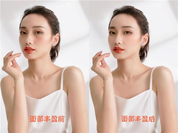 美图公司创新人像美容技术美颜相机、美图秀秀新增面部丰盈功能