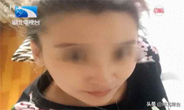 自体脂肪填充太痛苦了—自体脂肪丰胸安全可靠吗
